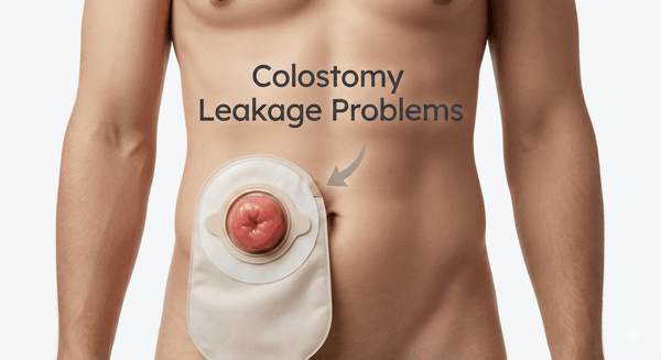 Produse Ostomie Gratuite & Mostre: Ghid Complet (2026)