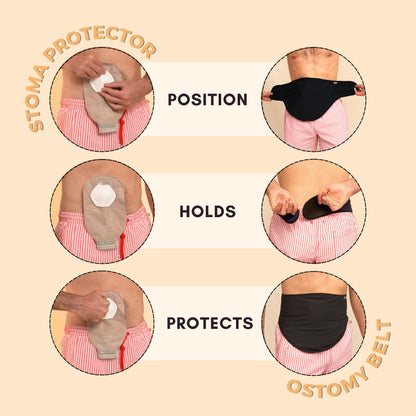 Best Ostomy Belt and Protector Combo for Colostomy & Illeostomy Support