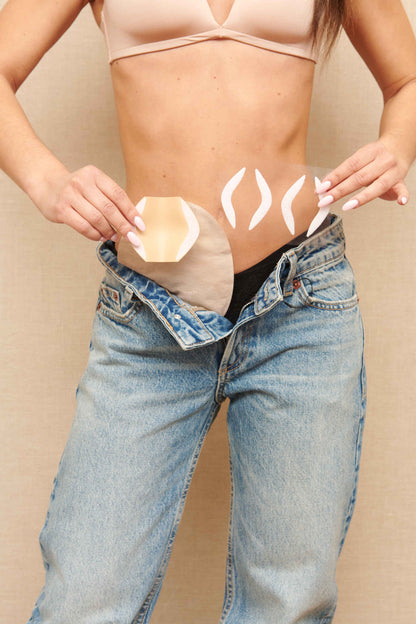 SIIL Stoma Protector – Rigid Ostomy Shield for Impact & Pressure Protection